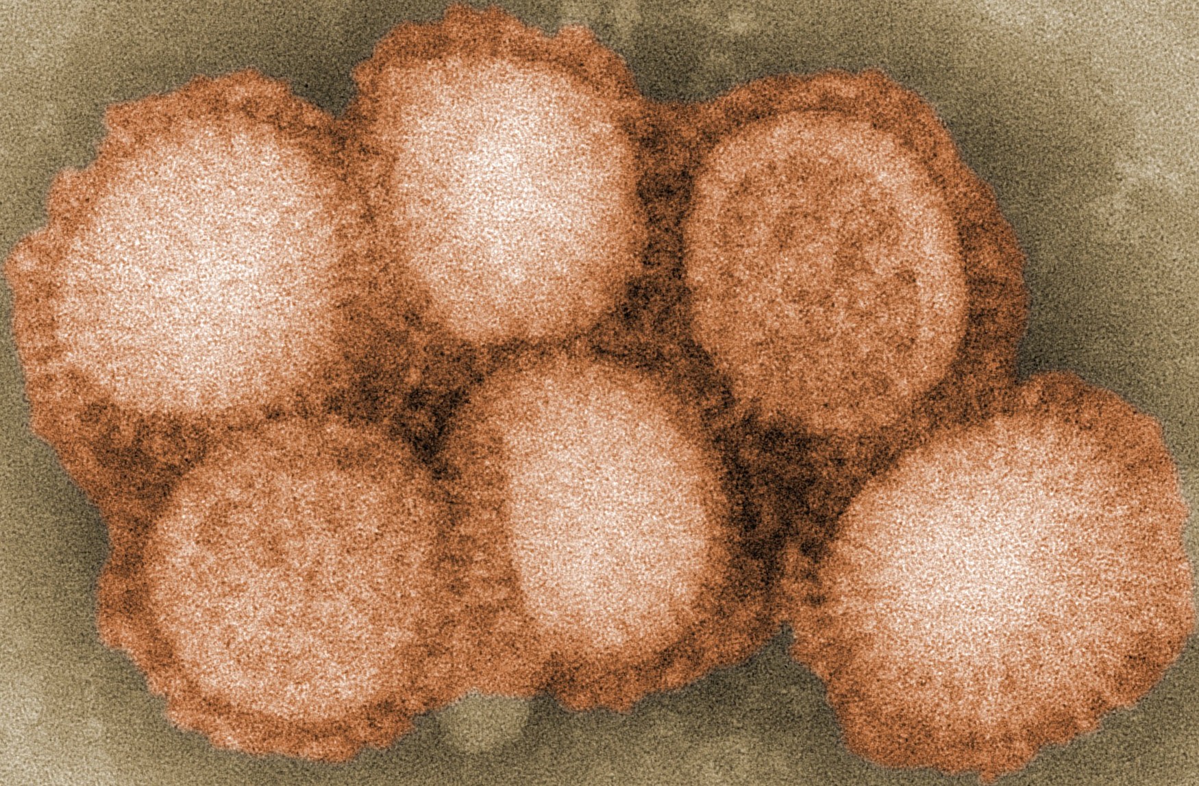 H1N1 virus microscopic look